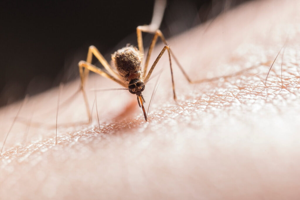 蚊子叮咬皮膚
